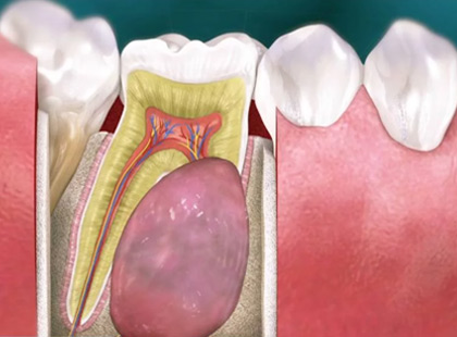 oral pathology